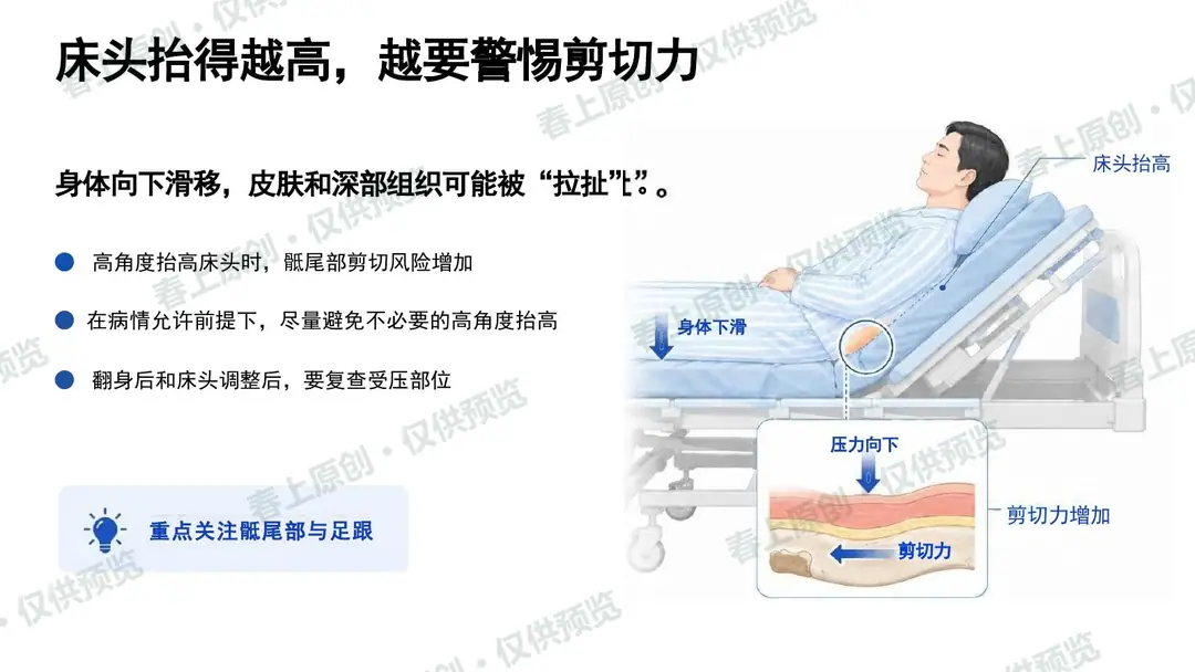 压力性损伤预防与护理管理预览第13页