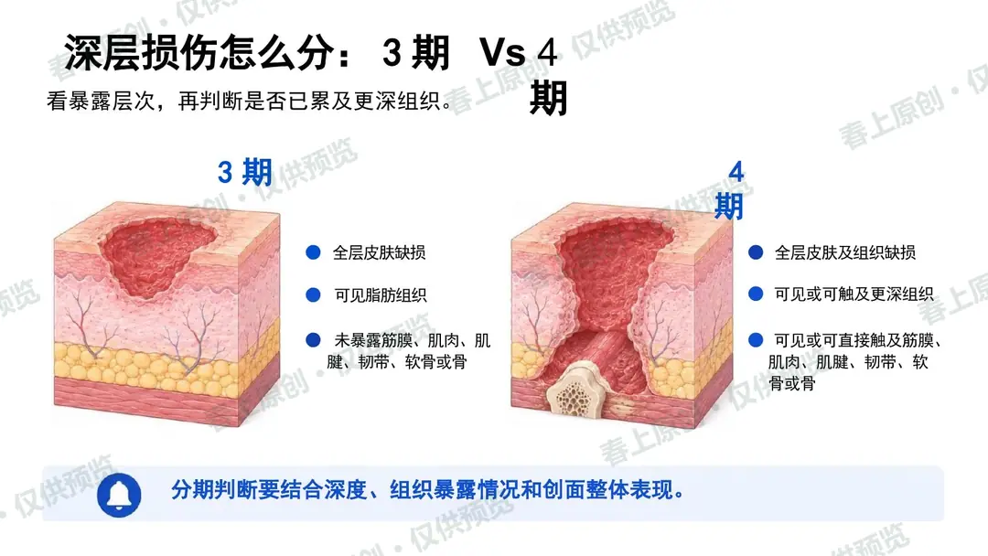 压力性损伤预防与护理管理预览第22页
